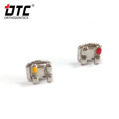 Los soportes metálicos de la serie DTC Bright La clave para el éxito del tratamiento de ortodoncia de clase II