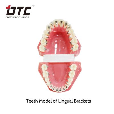 Estándar CE DTC Brackets ortodónticos de lengua para tratamiento ortodóntico de tamaño pequeño