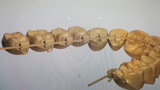 Fuente de maquinaria poderosa DTC Ortodoncia Brackets de la lengua con brackets autoligantes