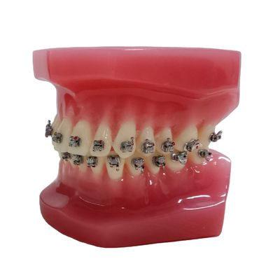 DTC Ortodoncia Dental Typodont Brackets Modelo hecho a medida para manual y OEM